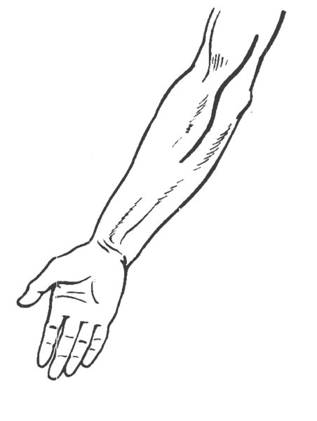 Рука предплечье