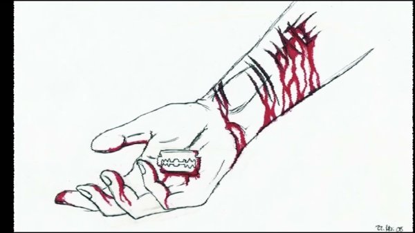 Кубитальная Вена верхней конечности