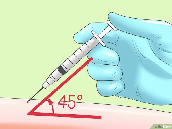Подкожная инъекция выполняется под углом