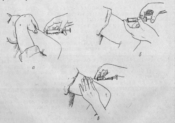 Выполнение подкожной инъекции алгоритм