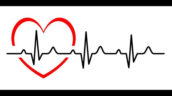 Кардиограмма сердца