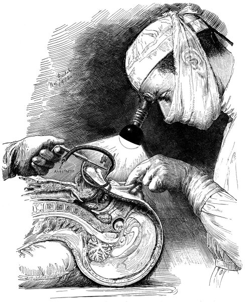 Медицинские иллюстрации