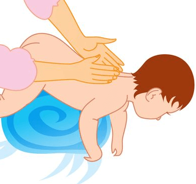Дренажный массаж ребенку для отхождения мокроты