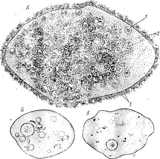 Амеба паразит