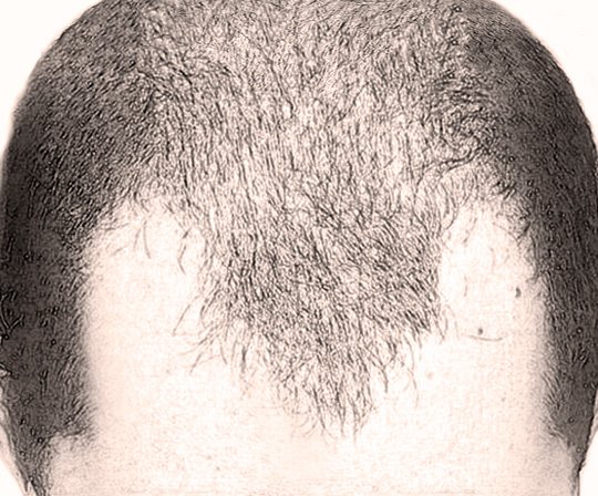 Седой затылок