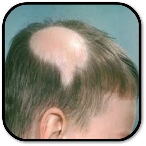 Седина от стресса