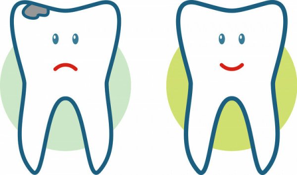 Здоровые и нездоровые зубы