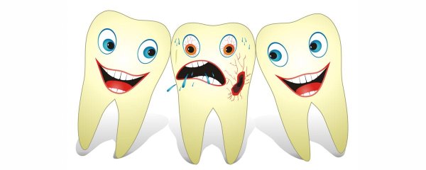 Мультяшный зуб с кариесом