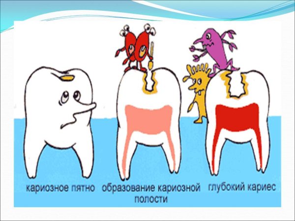 Грустный зуб