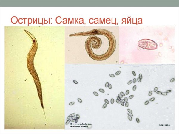 Острица самка и самец яйца