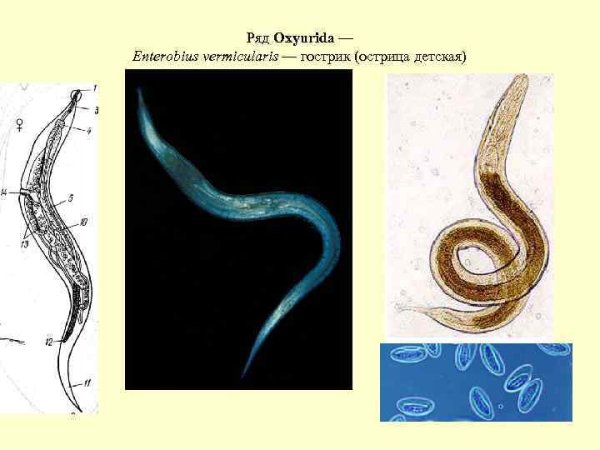 Enterobius vermicularis строение