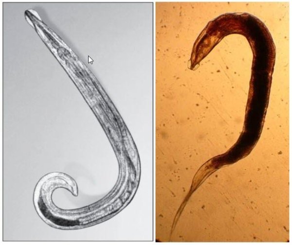 Половозрелая особь острицы