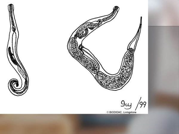Острица Enterobius vermicularis строение