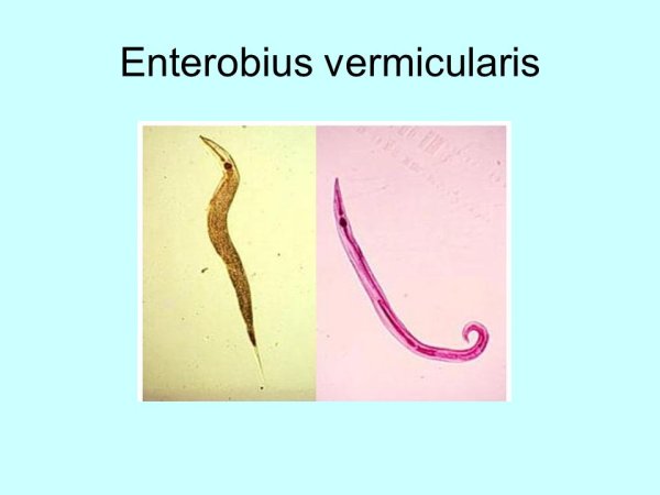 Половой диморфизм острицы