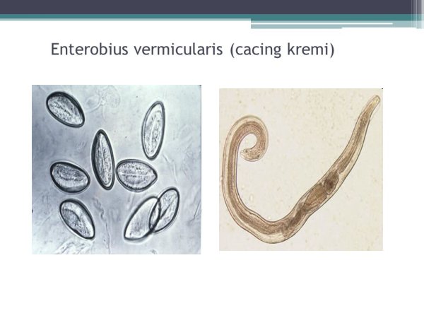enterobius vermicularis oxyuris