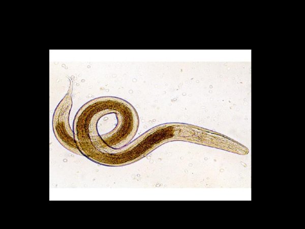 Власоглав самка