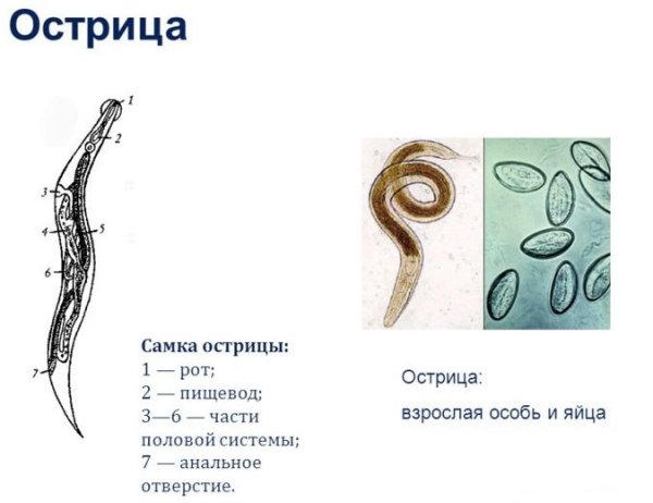 Тотальный препарат Enterobius vermicularis
