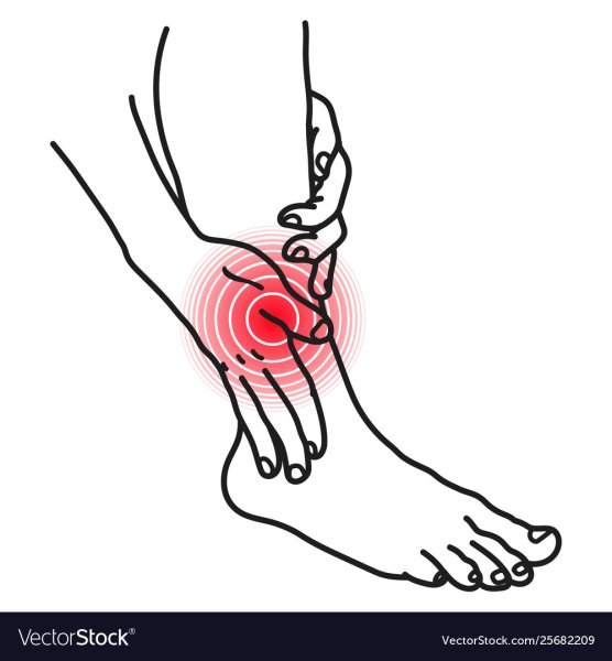 Нога болит иллюстрации