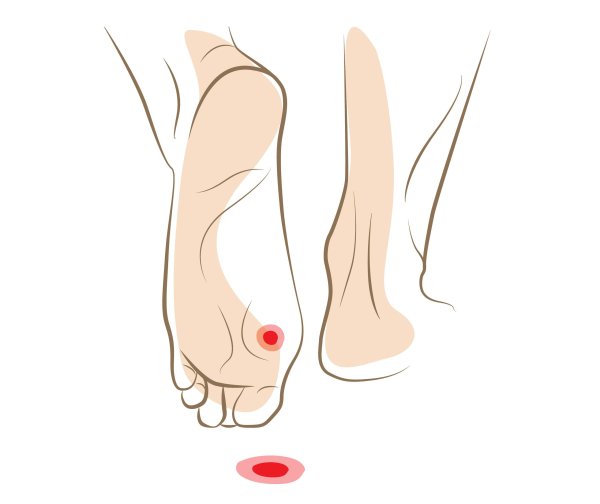 Отпечаток стопы