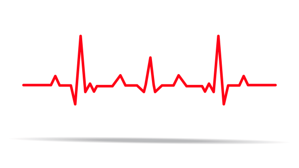 Кардиограмма сердца