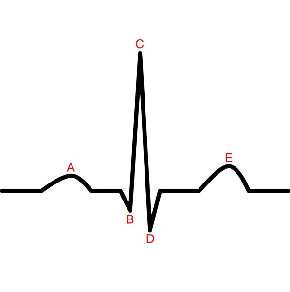 Изображение нормальной ЭКГ