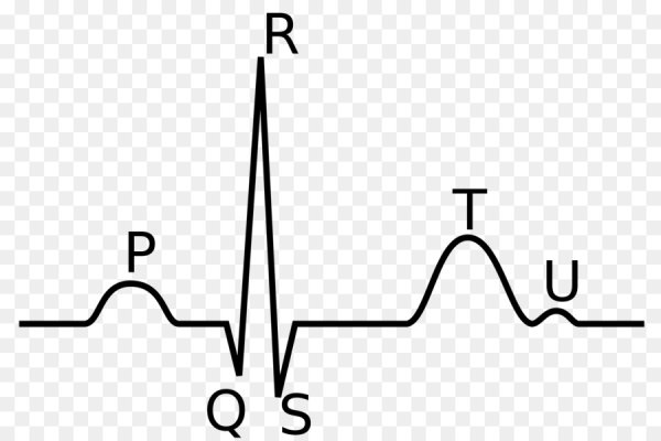Комплекс QRS на ЭКГ