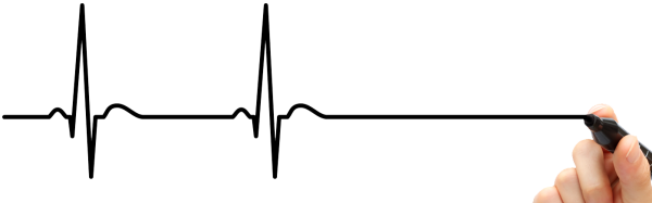 Линия кардиограммы на прозрачном фоне