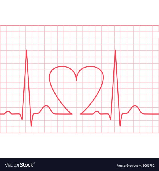 Диаграмма ЭКГ