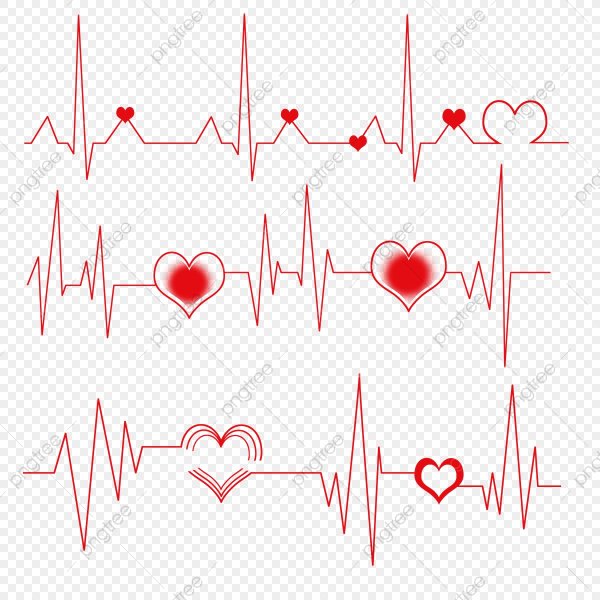 Кардиограмма в больнице