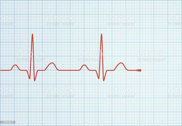 ЭКГ вектор