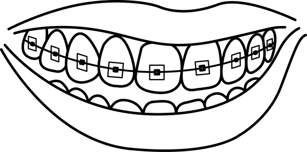 Брекеты нарисованные
