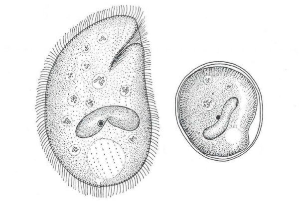 Циста балантидия строение