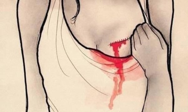 Боль рисунок