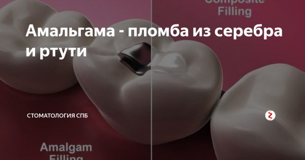 Амальгама Красноярск