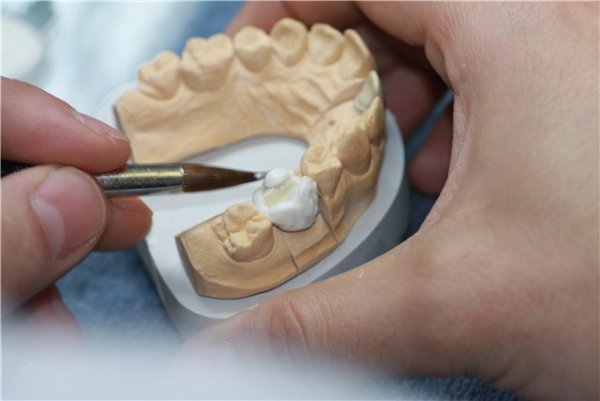 Керамика зуботехника