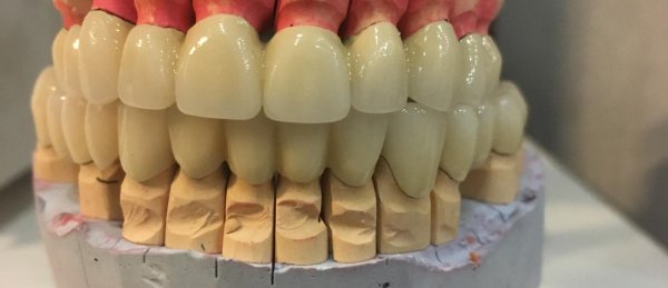 Зубному технику-керамисту.