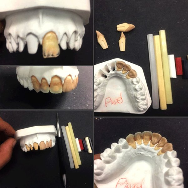 Зубные техники