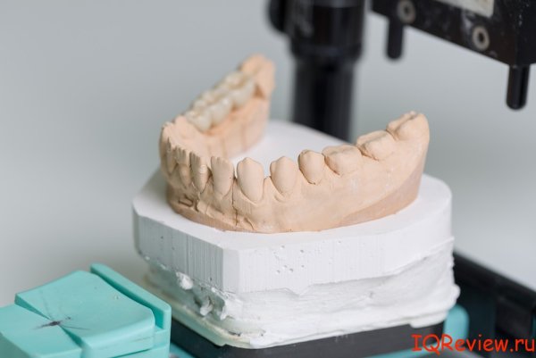 Профессия зубной техник