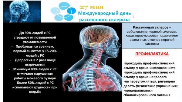 День рассеянного склероза
