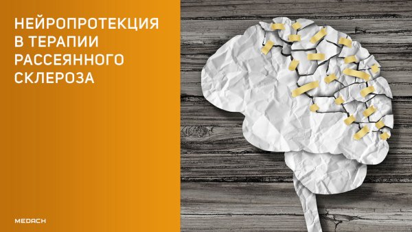 Нейродегенерация при рассеянном склерозе