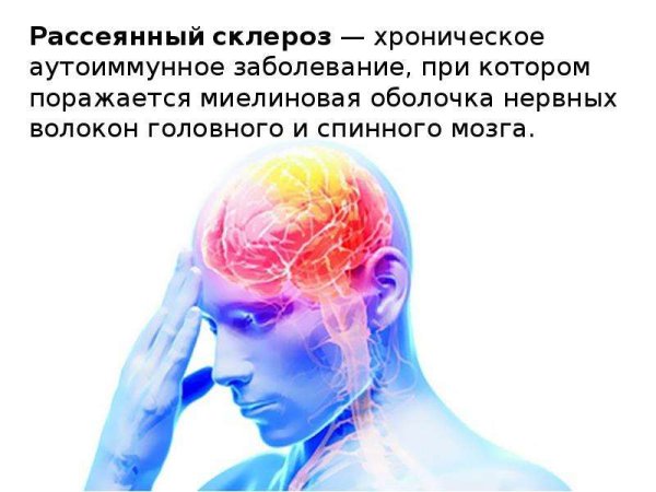 Склероз арт