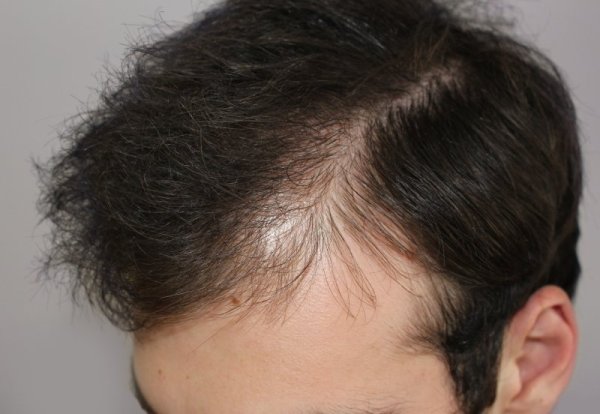 Непрокрашенные волосы на голове