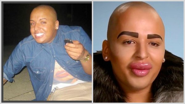 Накаченные губы