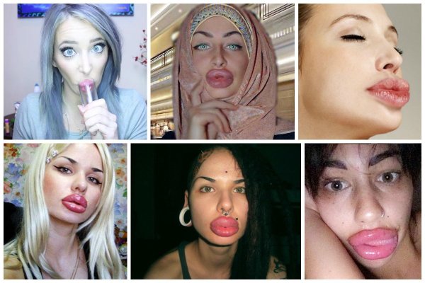 Анджелина Джоли губы накаченные