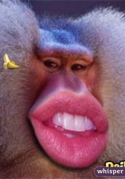 Губы накаченные ботоксом