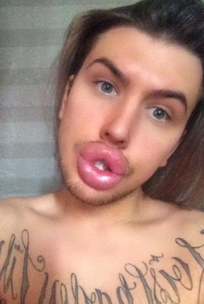 Накаченные губы у мужчин