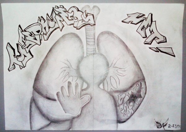 Туберкулез плакат