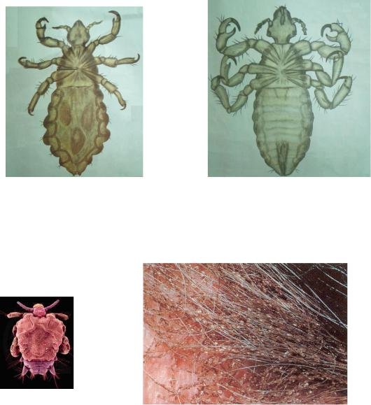 Лобковая вошь строение