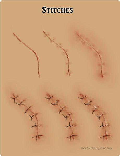 Шрам рисунок (49 фото)