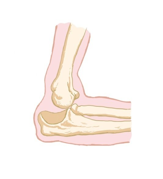Вывих плечевого сустава рисунок